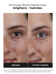 C5 Super Boost Moisturizer