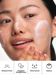 Regular Strength Acne Travel Trio