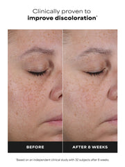 25% Vitamin C + Glutathione Clinical Serum