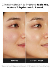 7% Ectoin + Hyaluronic Acid Milky Hydrating Serum